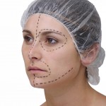 cosmetic surgery facelift cosmetic surgery facelift