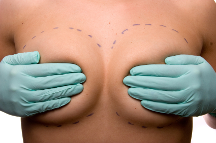 breast-implant-pictures