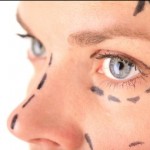 facelift