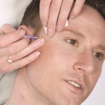 men and botox