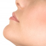 laser face lift
