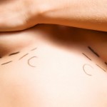 Breast Technology Breast Technology